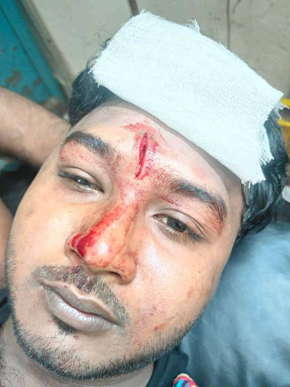 সীতাকুণ্ড পৌর ছাত্রলীগের কর্মি কায়সার হামিদ সামির উপর বিএনপির হামলা 