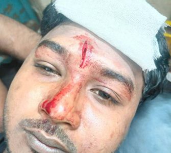 কায়সার হামিদ সামির উপর বিএনপির হামলা
