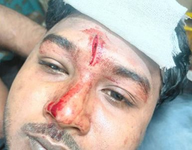 কায়সার হামিদ সামির উপর বিএনপির হামলা