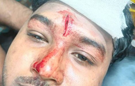কায়সার হামিদ সামির উপর বিএনপির হামলা