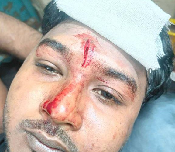 কায়সার হামিদ সামির উপর বিএনপির হামলা